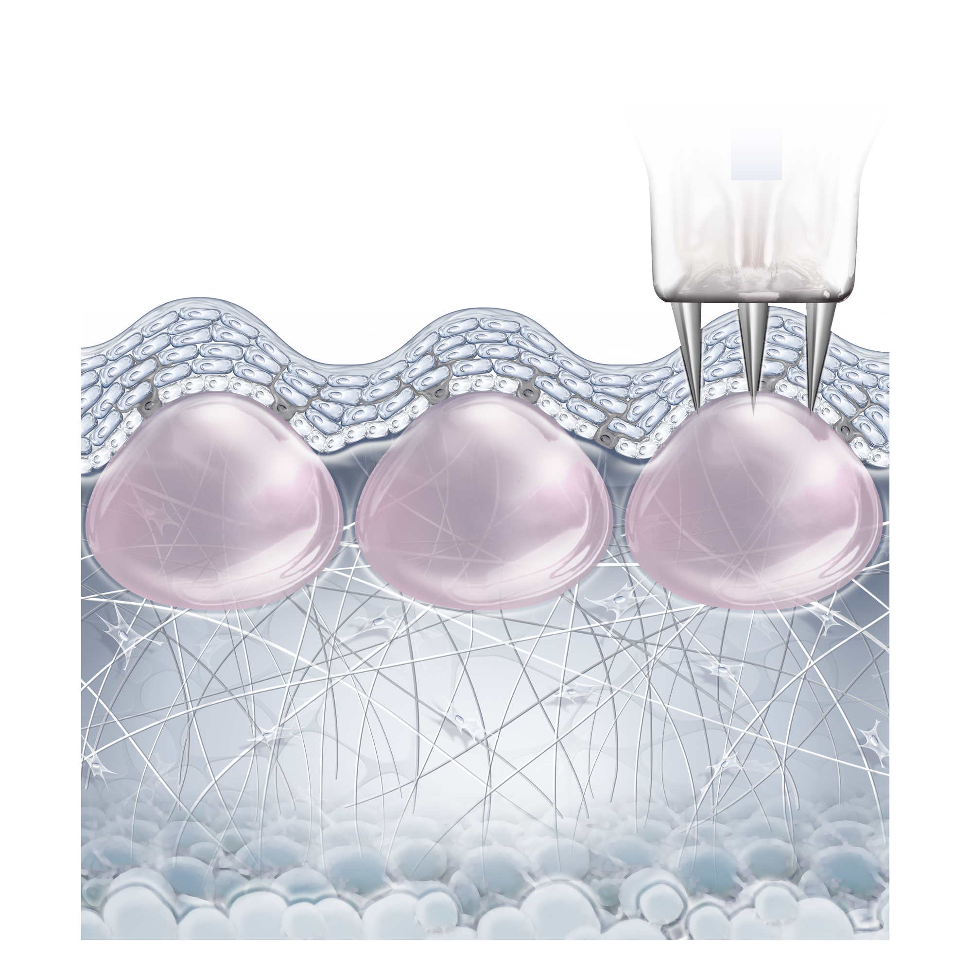 Fillmed NANOSOFT Microneedles